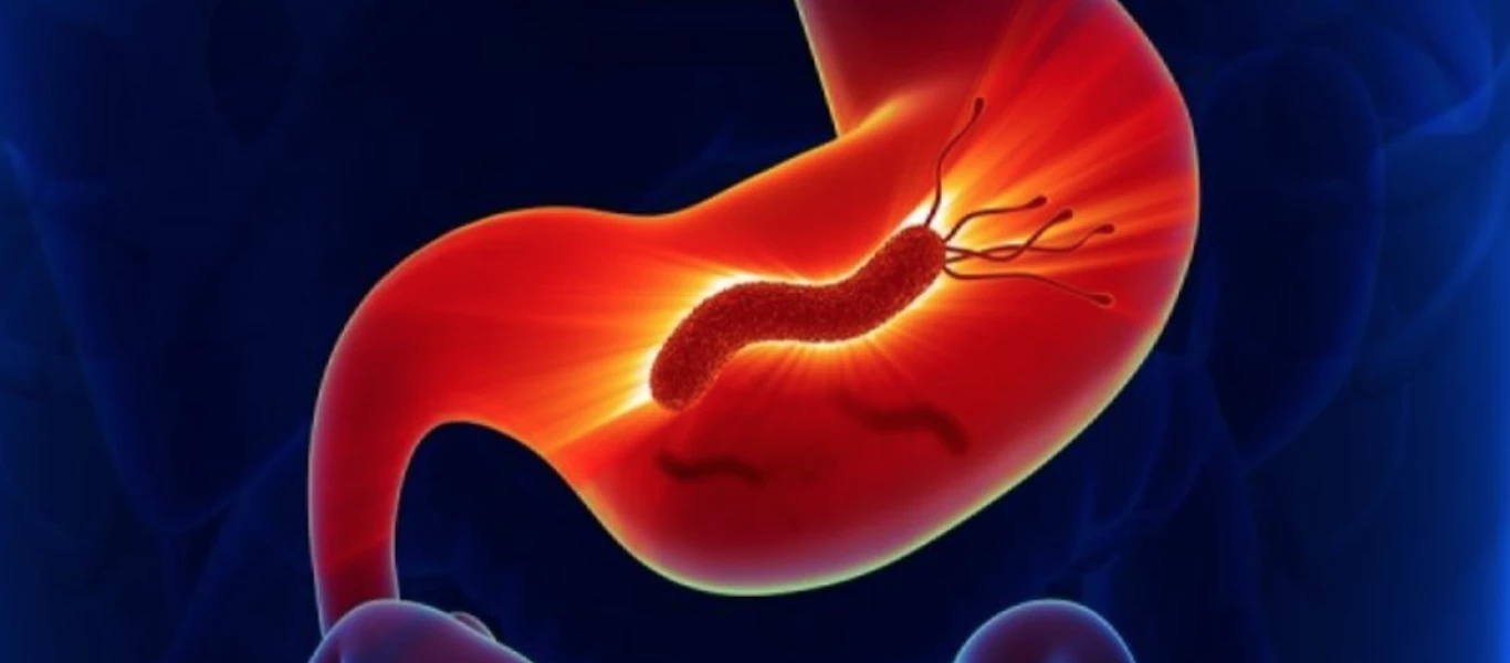 Έλκος στομάχου: Όλα όσα πρέπει να ξέρετε (βίντεο)